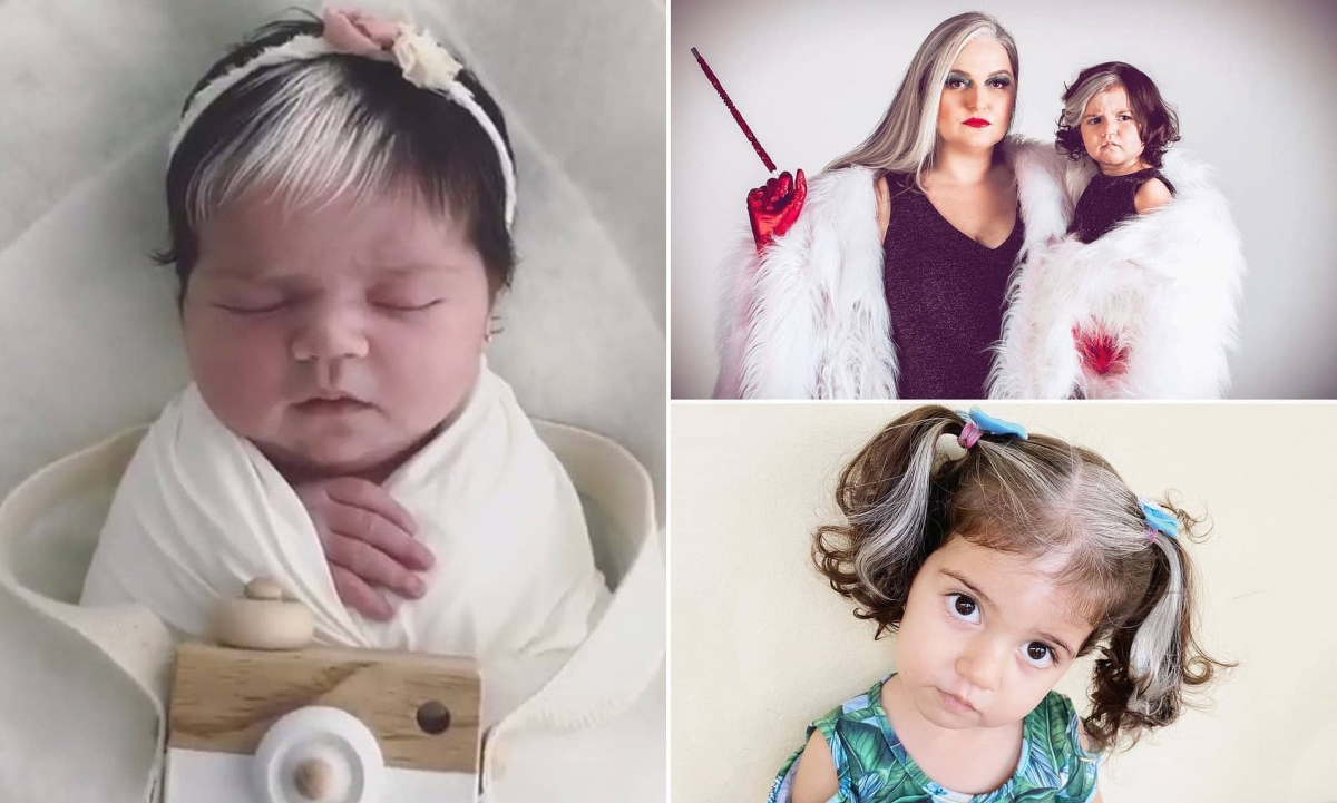 Nace bebé con mechón blanco y la llaman "Baby Cruella"