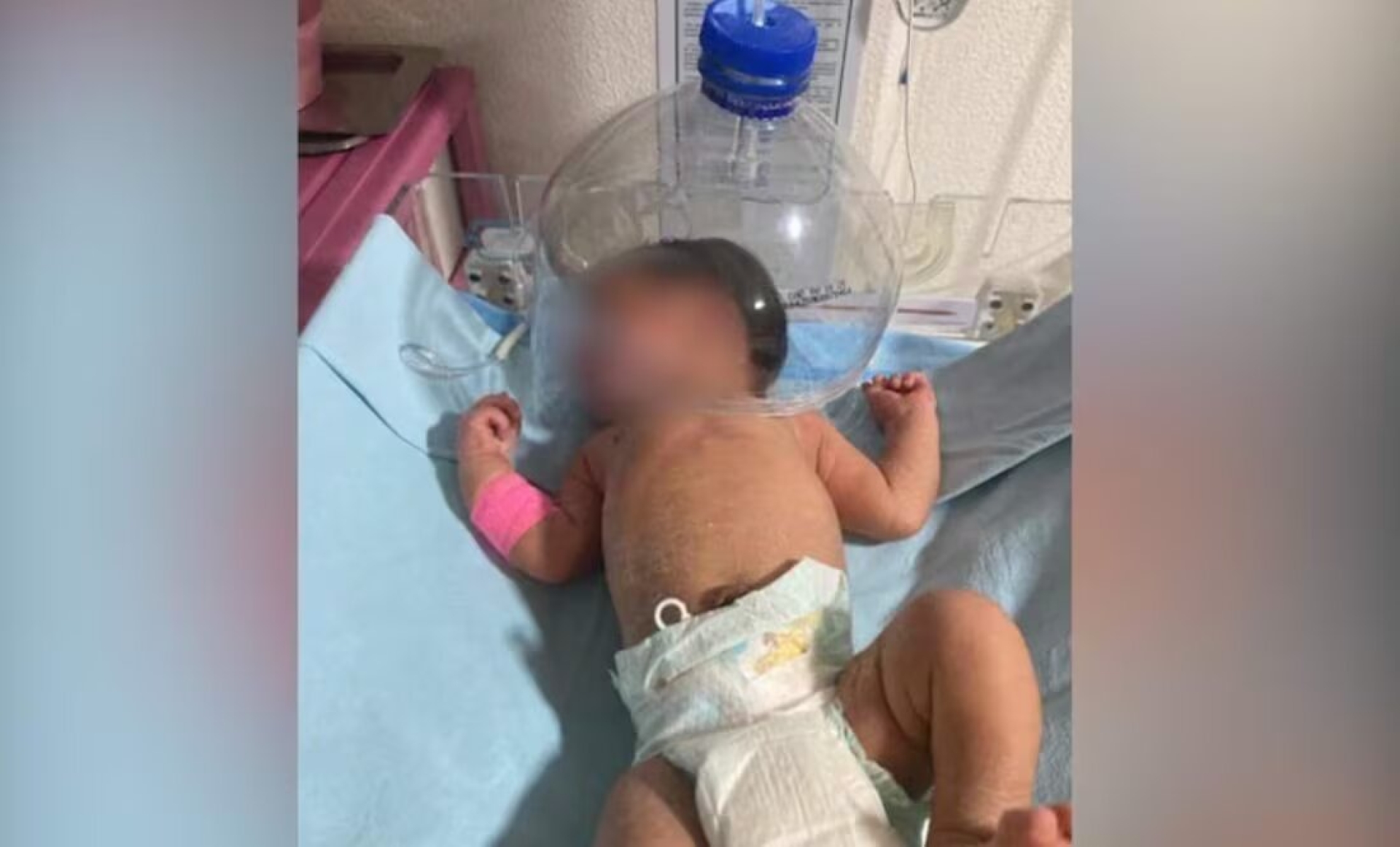 Por falta de insumos, usan botella como casco cefálico para bebé en IMSS-Bienestar Tabasco