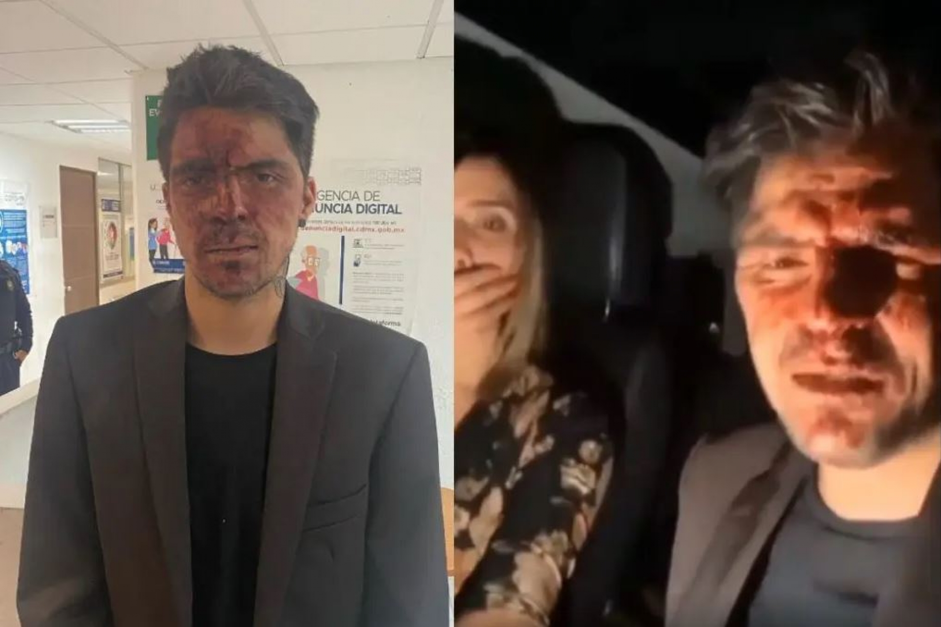 Hijo de Lupita D´Alessio denunció a Arturo Montiel por agresión física