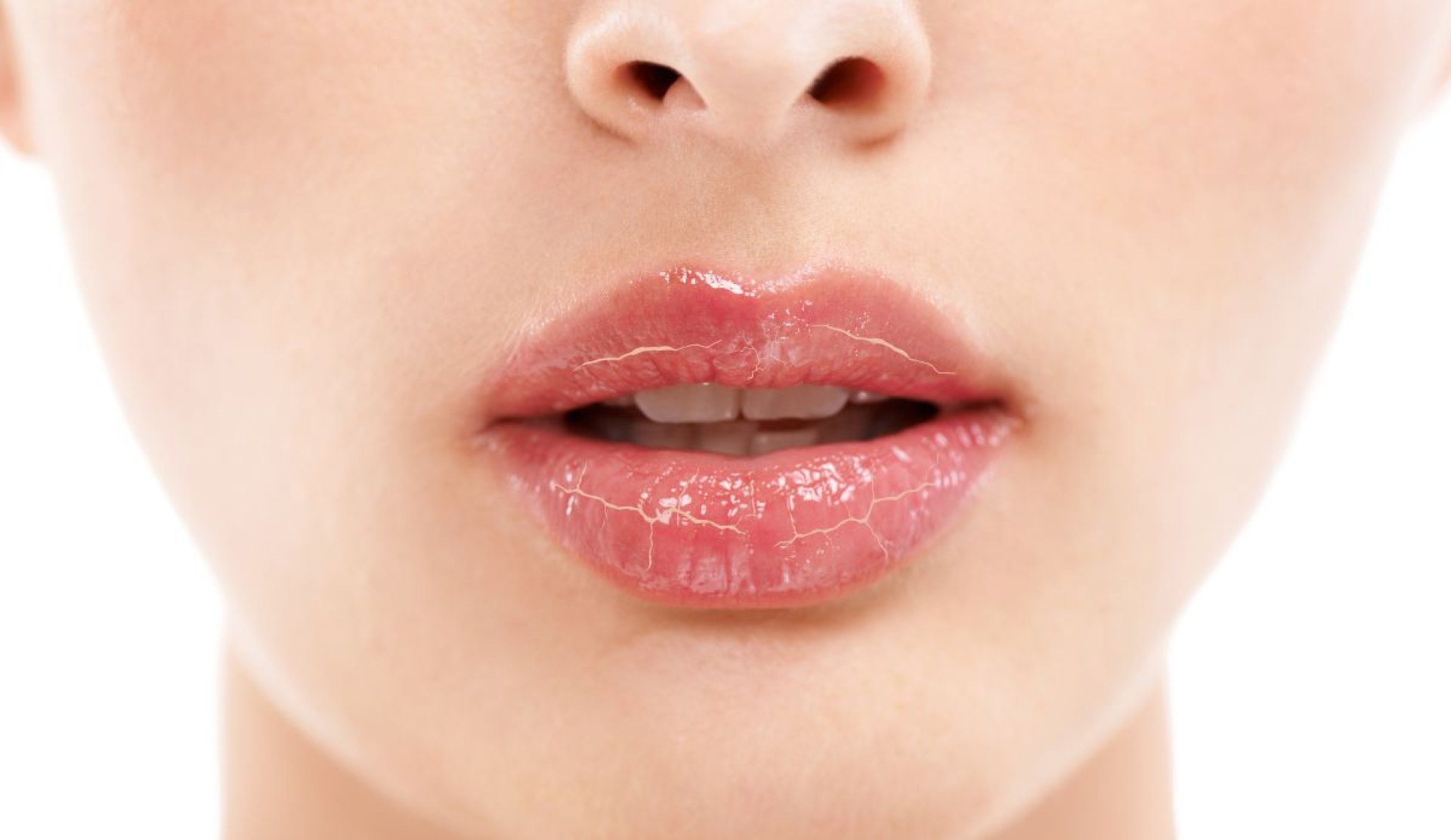 Cómo proteger tus labios y evitar la resequedad: ocho consejos prácticos