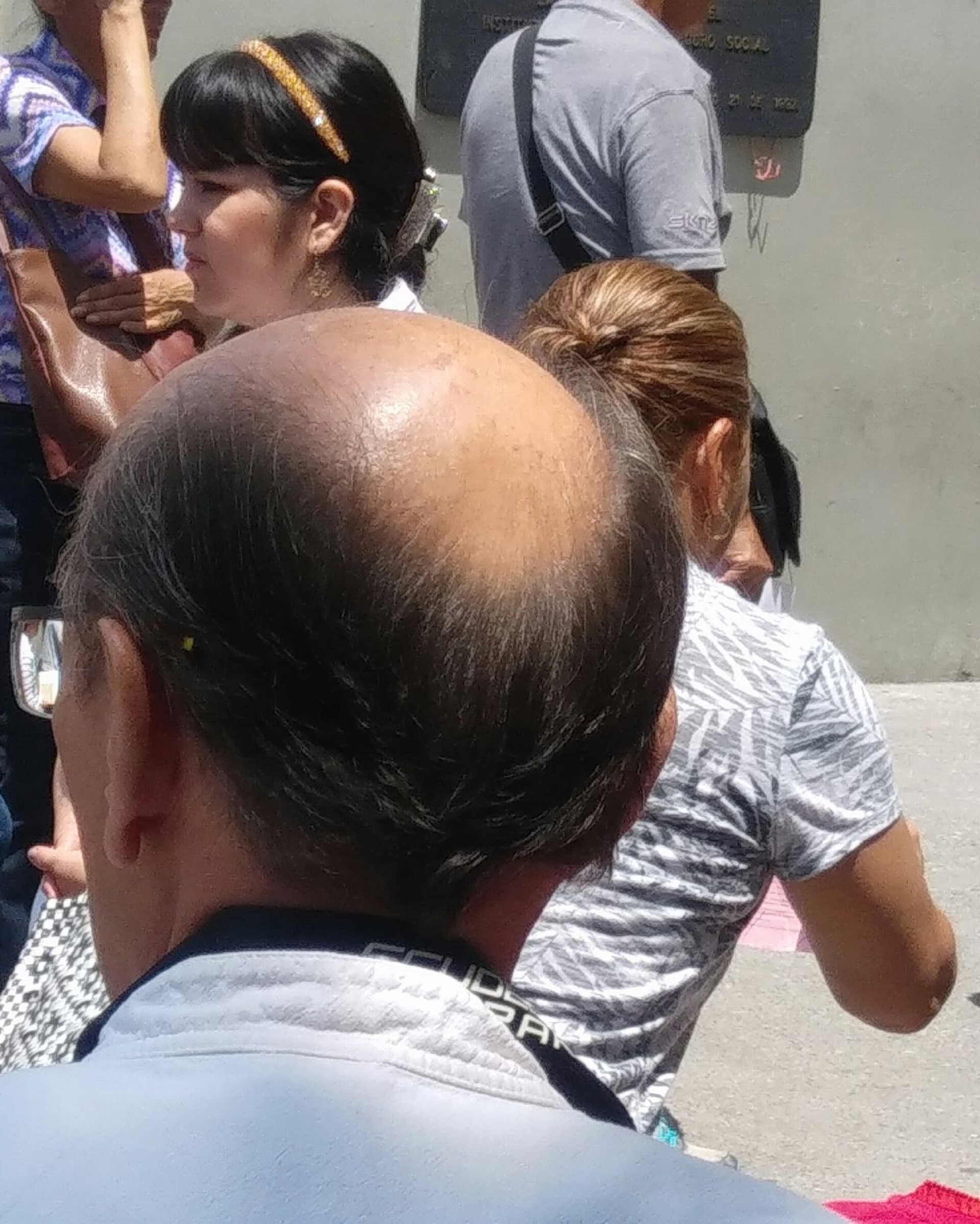 La principal causa de la caída del cabello es el estrés: especialista