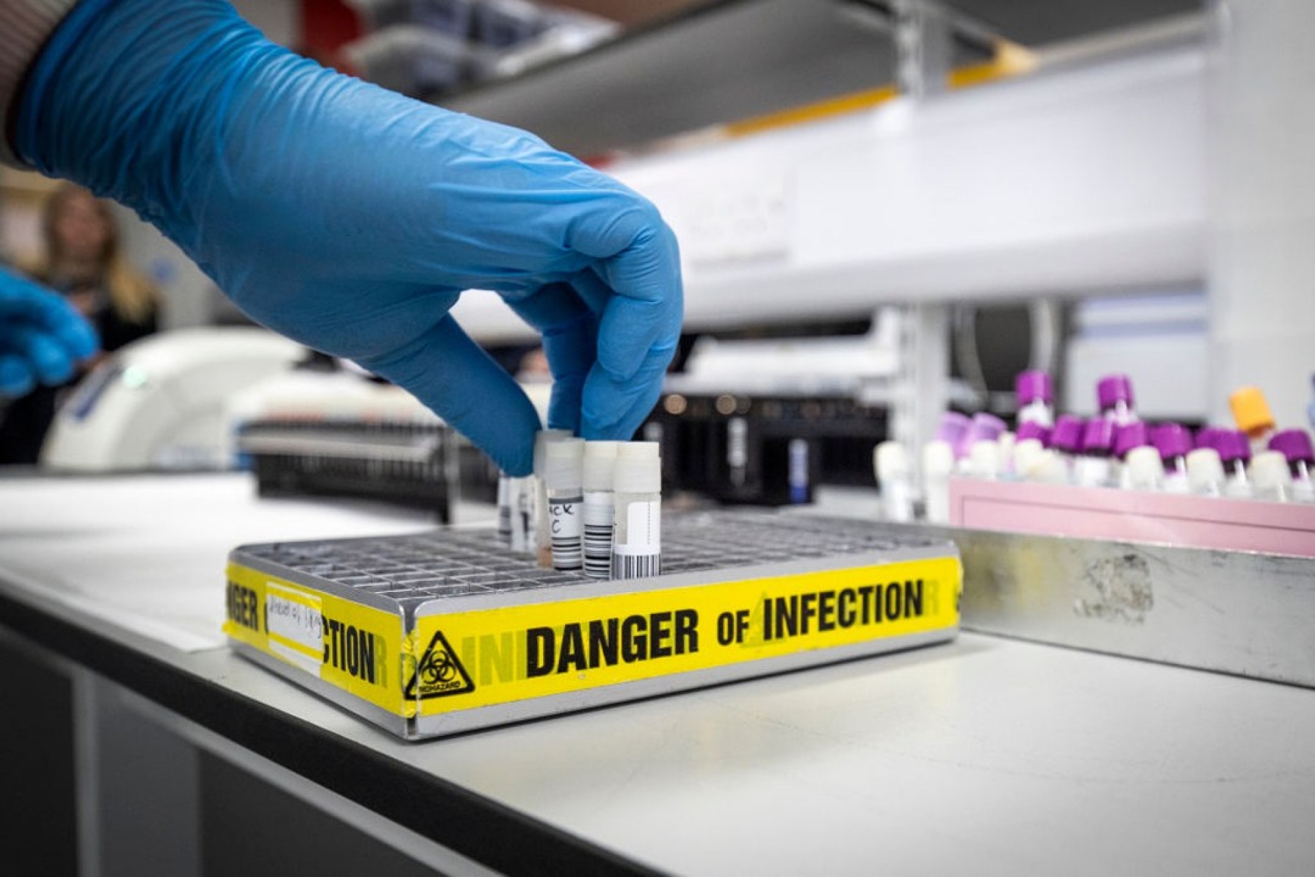 Ciudad china emite alerta sanitaria por un posible caso de peste bubónica