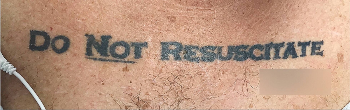 “No resucitar”: la última voluntad de un hombre, tatuada en el pecho