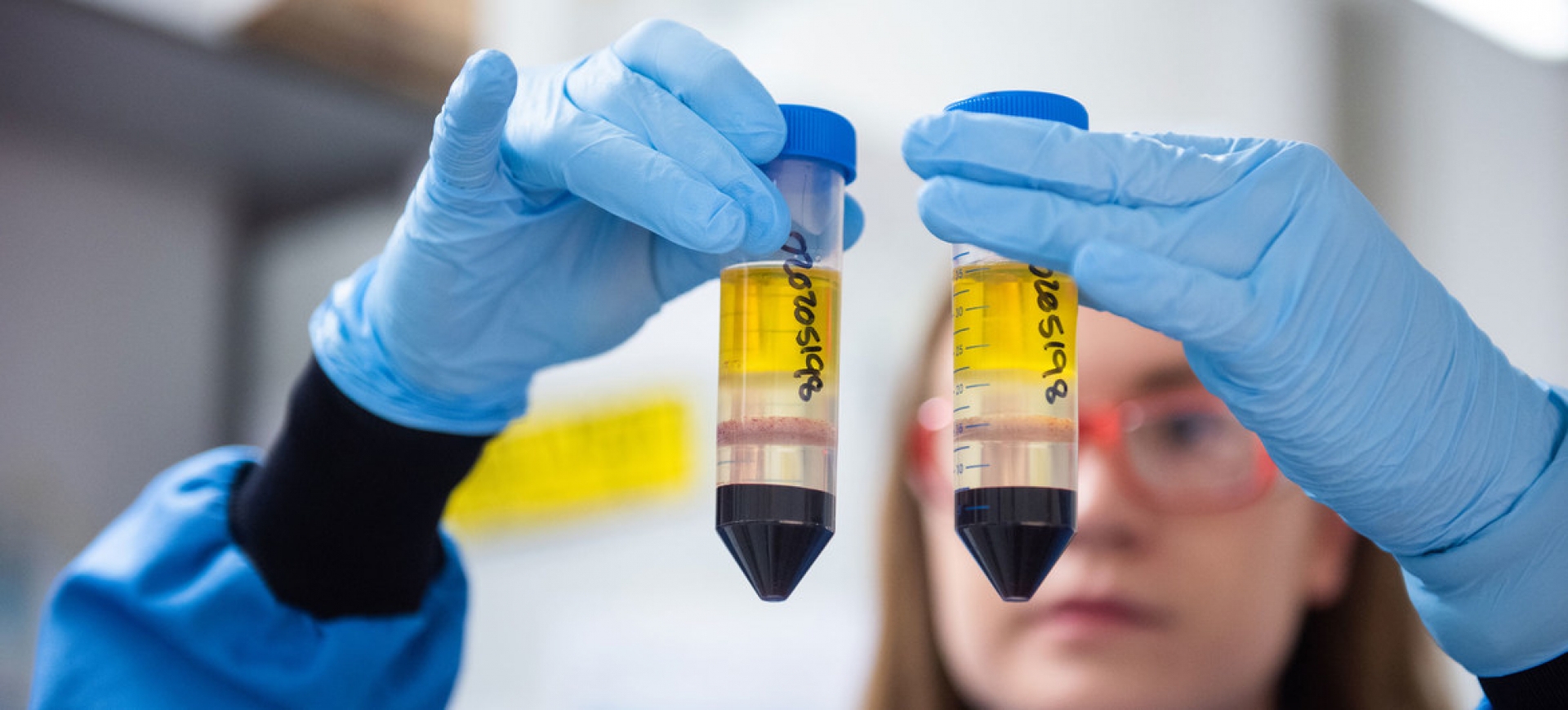 Oxford investigará posibilidad de combinar distintas vacunas