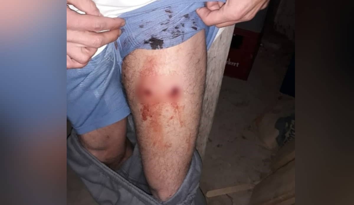 Fue herido de un balazo en una pierna